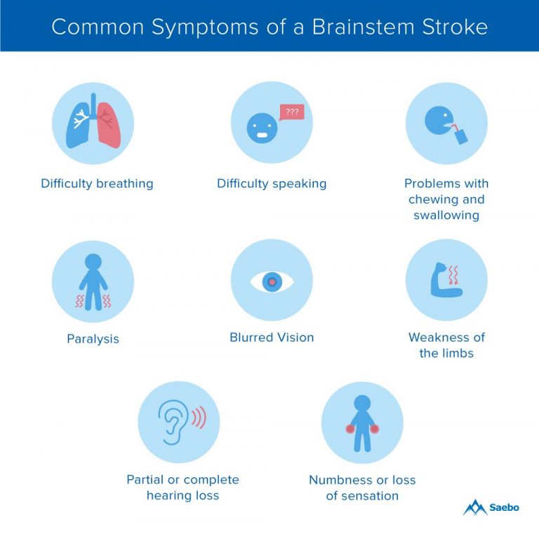 sympstroke Stroke info graphic